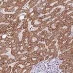 TOPAZ1 Polyclonal Antibody