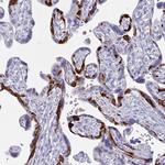 PEG10 Antibody in Immunohistochemistry (Paraffin) (IHC (P))