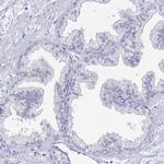 PEG10 Antibody in Immunohistochemistry (IHC)
