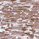 LMOD2 Antibody in Immunohistochemistry (Paraffin) (IHC (P))