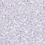 LMOD2 Antibody in Immunohistochemistry (Paraffin) (IHC (P))