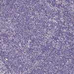 LMOD2 Polyclonal Antibody