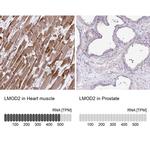 LMOD2 Antibody in Immunohistochemistry (IHC)