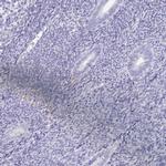 SPESP1 Antibody in Immunohistochemistry (IHC)