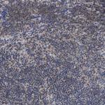 ANKRD55 Polyclonal Antibody