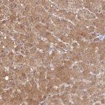 SULT1A2 Antibody in Immunohistochemistry (Paraffin) (IHC (P))