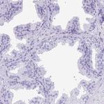 SULT1A2 Antibody in Immunohistochemistry (Paraffin) (IHC (P))