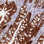 SULT1A2 Antibody in Immunohistochemistry (Paraffin) (IHC (P))