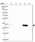 SULT1A2 Antibody in Western Blot (WB)