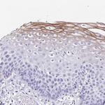 TMPRSS11E Antibody in Immunohistochemistry (Paraffin) (IHC (P))