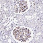 TMPRSS11E Antibody in Immunohistochemistry (Paraffin) (IHC (P))