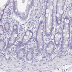 TMPRSS11E Antibody in Immunohistochemistry (Paraffin) (IHC (P))