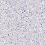 TMPRSS11E Antibody in Immunohistochemistry (Paraffin) (IHC (P))
