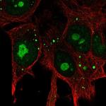 KIAA1755 Polyclonal Antibody