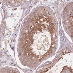 KIAA1755 Antibody in Immunohistochemistry (Paraffin) (IHC (P))