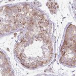 FAM105B Antibody in Immunohistochemistry (Paraffin) (IHC (P))