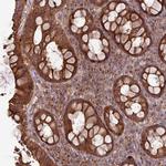 RAB19 Polyclonal Antibody