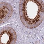 KIAA1211L Polyclonal Antibody