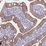MRPS14 Antibody in Immunohistochemistry (Paraffin) (IHC (P))
