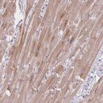 MRPS14 Antibody in Immunohistochemistry (Paraffin) (IHC (P))