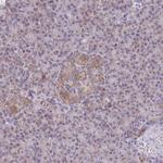MRPS14 Antibody in Immunohistochemistry (Paraffin) (IHC (P))