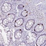 OR6C6 Polyclonal Antibody