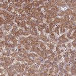 ST3GAL3 Polyclonal Antibody