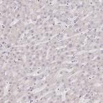 FAM63B Antibody in Immunohistochemistry (Paraffin) (IHC (P))