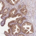 FAM63B Antibody in Immunohistochemistry (Paraffin) (IHC (P))