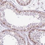 FAM63B Antibody in Immunohistochemistry (Paraffin) (IHC (P))