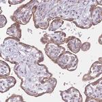 LIN7C Antibody in Immunohistochemistry (Paraffin) (IHC (P))