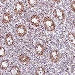 LIN7C Antibody in Immunohistochemistry (Paraffin) (IHC (P))