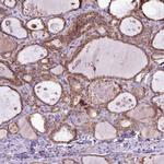 LIN7C Antibody in Immunohistochemistry (Paraffin) (IHC (P))