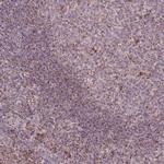 LIN7C Polyclonal Antibody