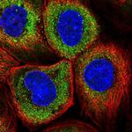 RNF23 Polyclonal Antibody