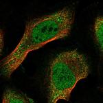 EID1 Polyclonal Antibody