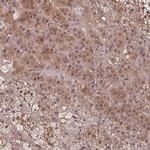 EID1 Polyclonal Antibody