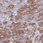 TIAF1 Polyclonal Antibody