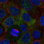 APS Polyclonal Antibody