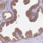 APS Antibody in Immunohistochemistry (Paraffin) (IHC (P))