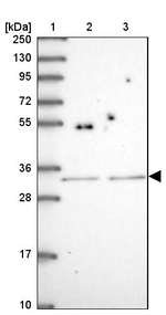 APS Antibody in Western Blot (WB)