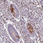 ZNF835 Antibody in Immunohistochemistry (Paraffin) (IHC (P))