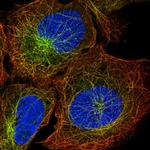 ZNF835 Polyclonal Antibody