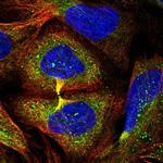 AHSA2 Polyclonal Antibody