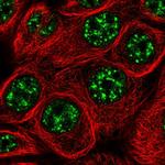 C6orf52 Antibody in Immunocytochemistry (ICC/IF)