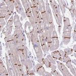 C2orf68 Antibody in Immunohistochemistry (Paraffin) (IHC (P))