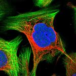 PRKRIP1 Antibody in Immunocytochemistry (ICC/IF)