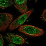 Meteorin Polyclonal Antibody