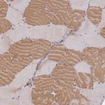 Meteorin Antibody in Immunohistochemistry (Paraffin) (IHC (P))