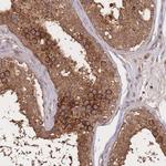 Meteorin Antibody in Immunohistochemistry (Paraffin) (IHC (P))
